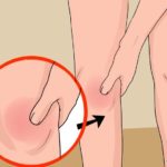 hardlopen blessure knie